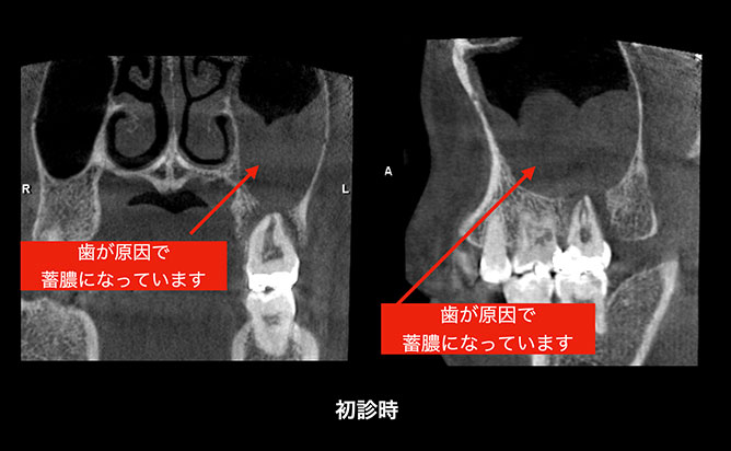 Before