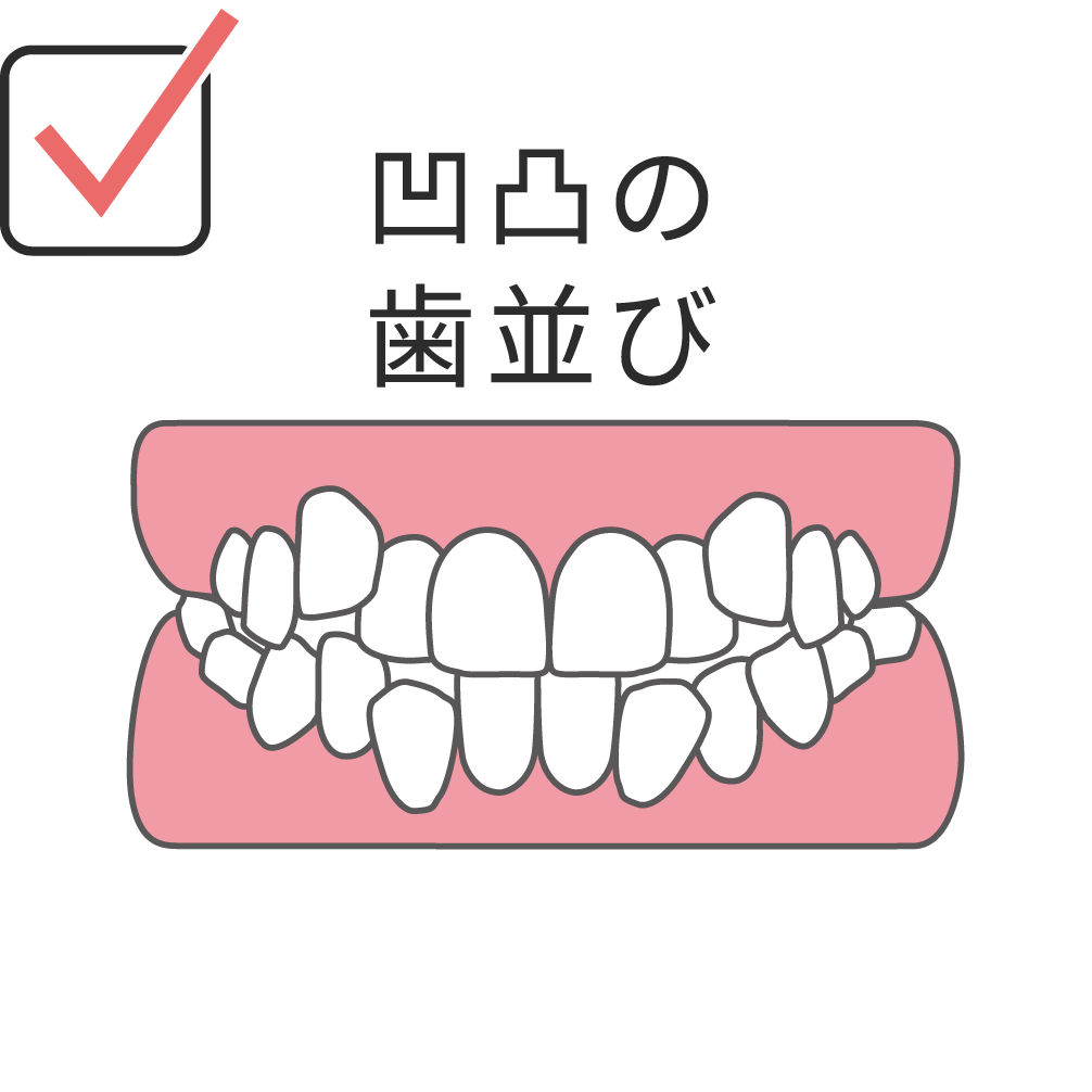 crooked-teeth