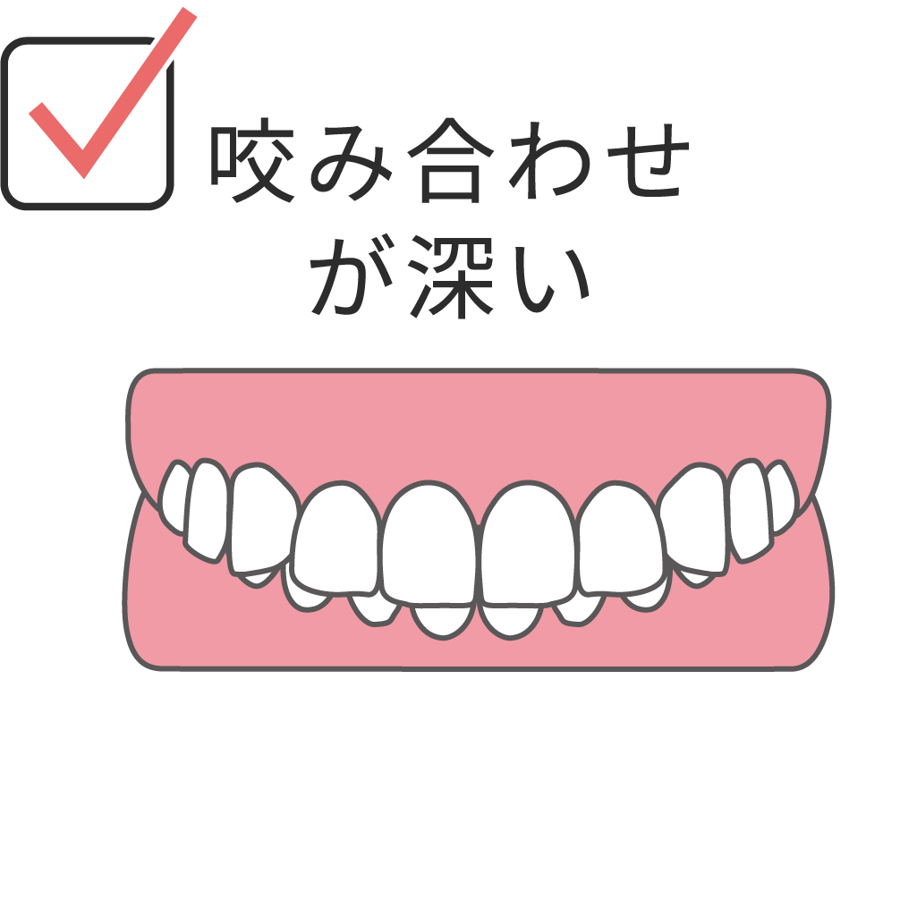 overbite